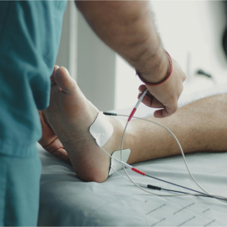 6 Tanda stroke pada kaki: Gejala apa saja yang perlu diwaspadai?