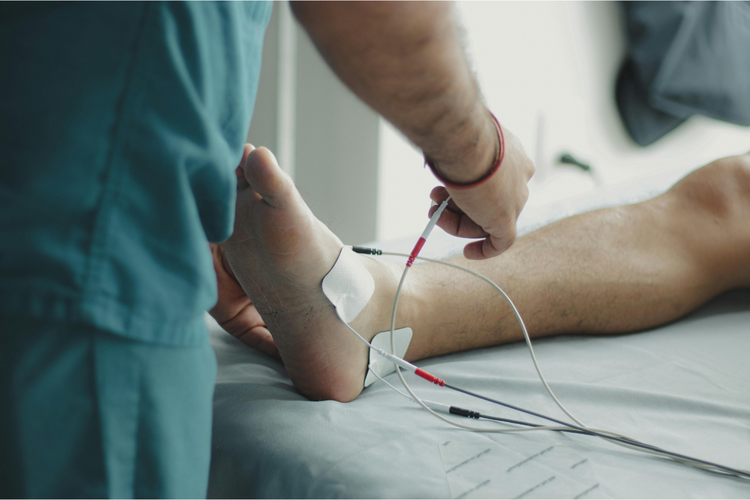 6 Tanda stroke pada kaki: Gejala apa saja yang perlu diwaspadai?